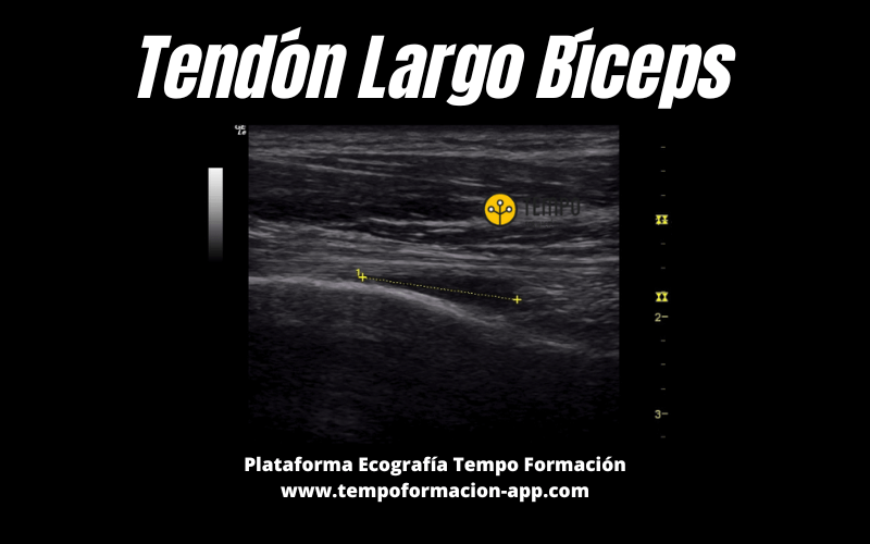 7. Tendon Largo Biceps Ecografia Tempo Formacion.png